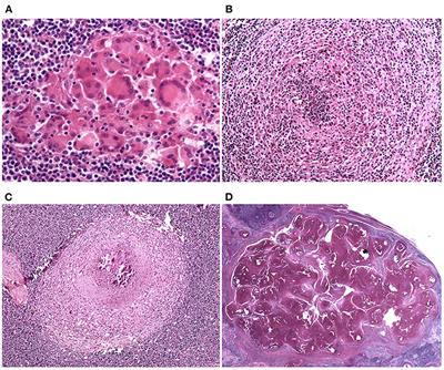 Mycobacterium microti Infection in Wild Boar (Sus scrofa): Histopathology Analysis Suggests Containment of the Infection